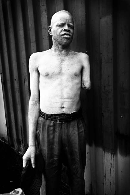 Art and Documentary Photography - Loading FVO-Albino-Killing-Tanzania-4.jpg