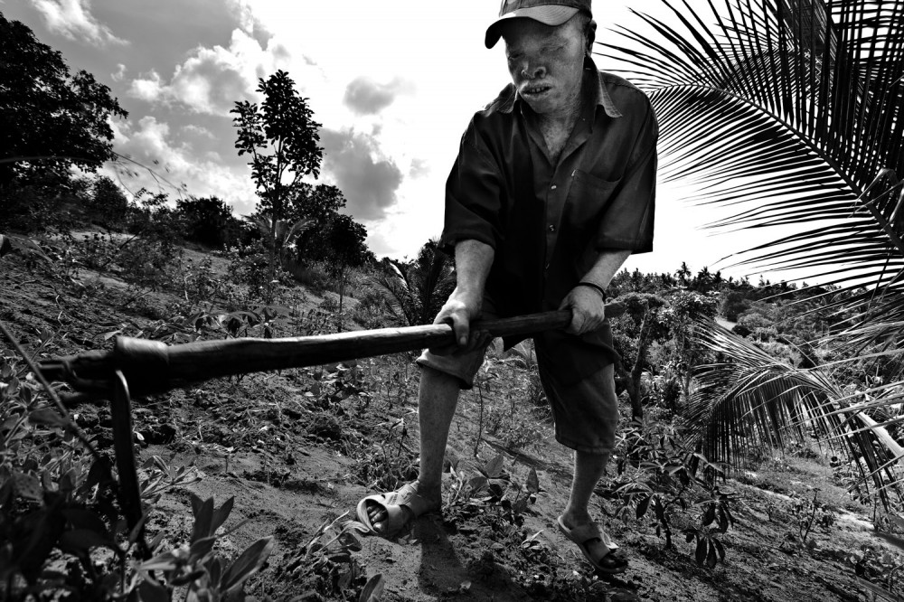 Art and Documentary Photography - Loading FVO-Albino-Killing-Tanzania-11.jpg