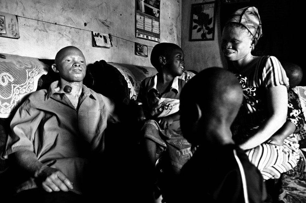 Art and Documentary Photography - Loading FVO-Albino-Killing-Tanzania-12.jpg