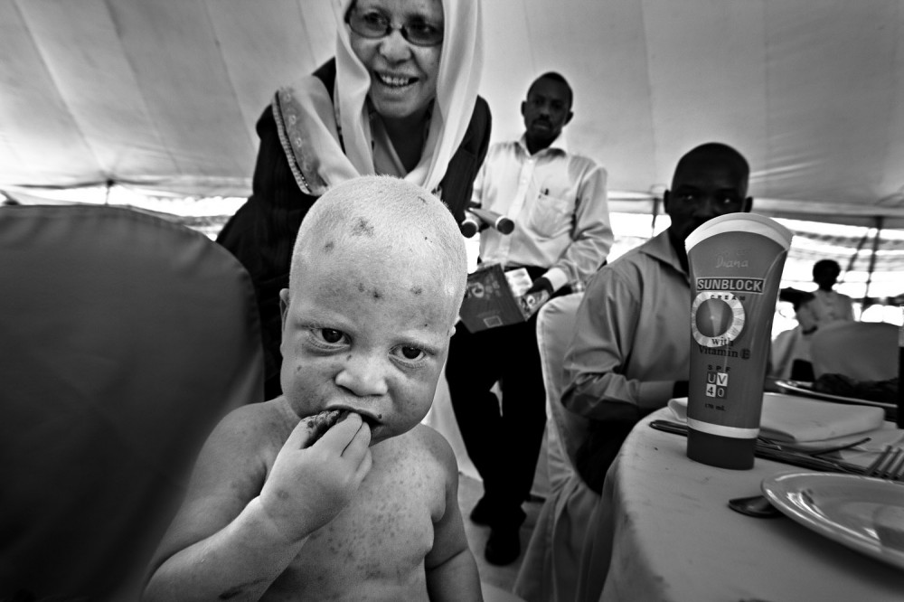 Art and Documentary Photography - Loading FVO-Albino-Killing-Tanzania-15.jpg