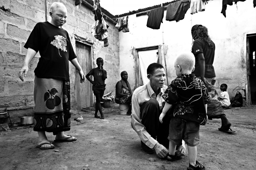 Art and Documentary Photography - Loading FVO-Albino-Killing-Tanzania-18.jpg