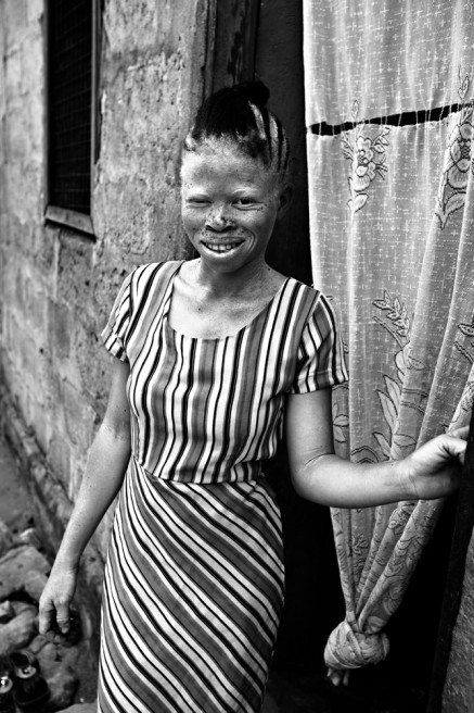 Art and Documentary Photography - Loading FVO-Albino-Killing-Tanzania-19.jpg