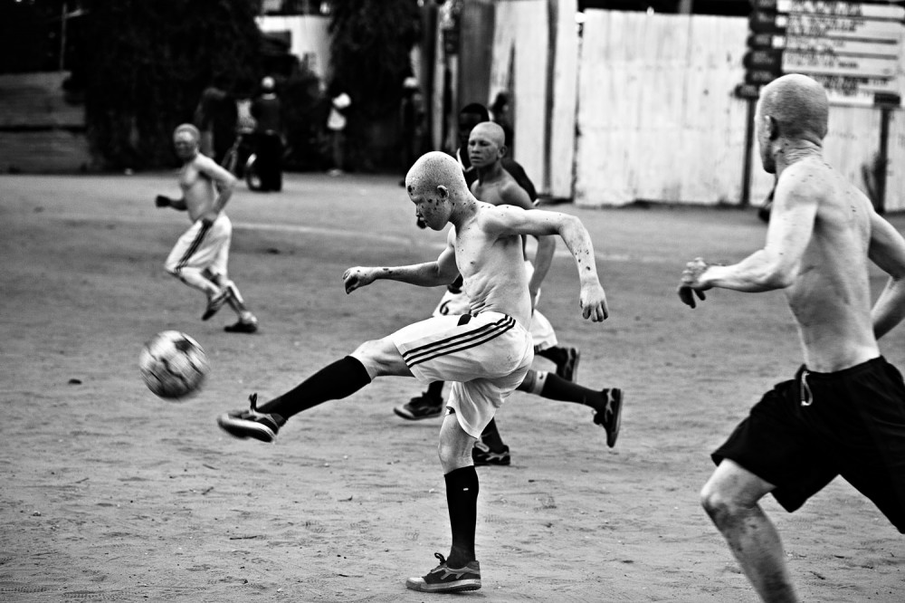 Art and Documentary Photography - Loading FVO-Albino-Killing-Tanzania-26.jpg