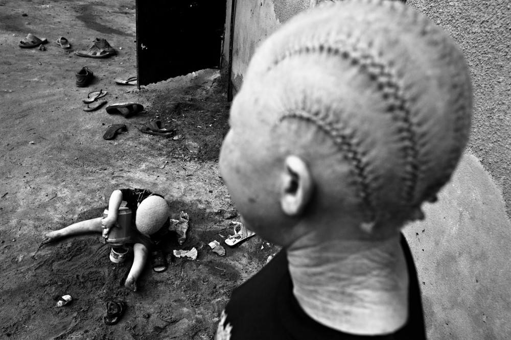 Art and Documentary Photography - Loading FVO-Albino-Killing-Tanzania-27.jpg
