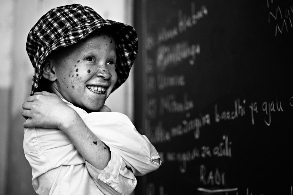 Art and Documentary Photography - Loading FVO-Albino-Killing-Tanzania-30.jpg